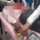 सतना में बीजेपी पार्षद पर हमला, फल बेचने वाले ने सीने में मारा छुरा; गंभीर हालत में रीवा रेफर