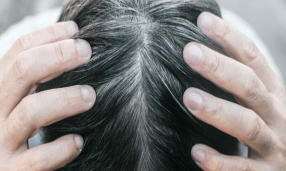 झड़ते बालों से परेशान लोगों के लिए 'रामबाण' है डॉ. बत्रा की किताब 'Hair'