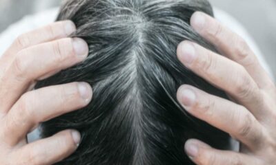 झड़ते बालों से परेशान लोगों के लिए 'रामबाण' है डॉ. बत्रा की किताब 'Hair'