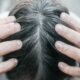 झड़ते बालों से परेशान लोगों के लिए 'रामबाण' है डॉ. बत्रा की किताब 'Hair'