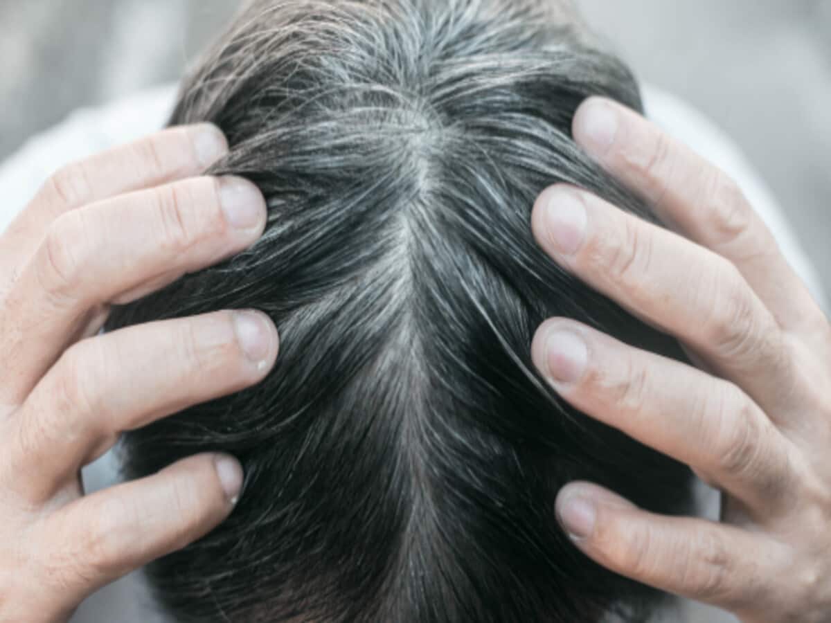 झड़ते बालों से परेशान लोगों के लिए 'रामबाण' है डॉ. बत्रा की किताब 'Hair' झड़ते बालों से परेशान लोगों के लिए 'रामबाण' है डॉ. बत्रा की किताब 'Hair'
