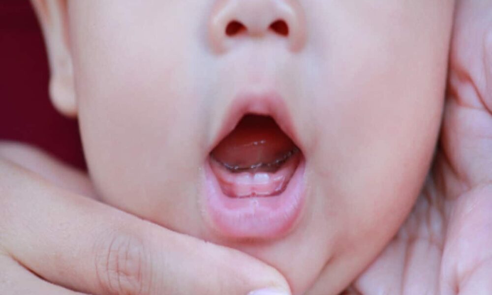 Teething Problem: दांत निकलने के दौरान बच्चों को हो रही तकलीफ तो आराम दिलाएंगे ये तरीके