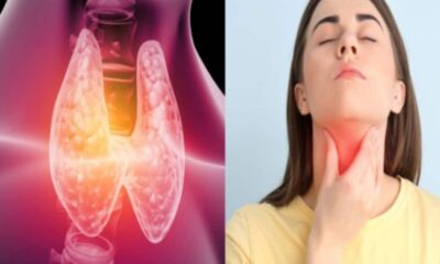 these-5-essential-nutrients-to-your-diet-to-control-thyroid-problems – पोषक तत्वों की कमी से गंभीर हो सकती है थायराॅइड की समस्या, इन 5 पोषक तत्वों का जरूर रखें ध्यान, लाइफस्टाइल न्यूज