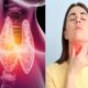 these-5-essential-nutrients-to-your-diet-to-control-thyroid-problems – पोषक तत्वों की कमी से गंभीर हो सकती है थायराॅइड की समस्या, इन 5 पोषक तत्वों का जरूर रखें ध्यान, लाइफस्टाइल न्यूज