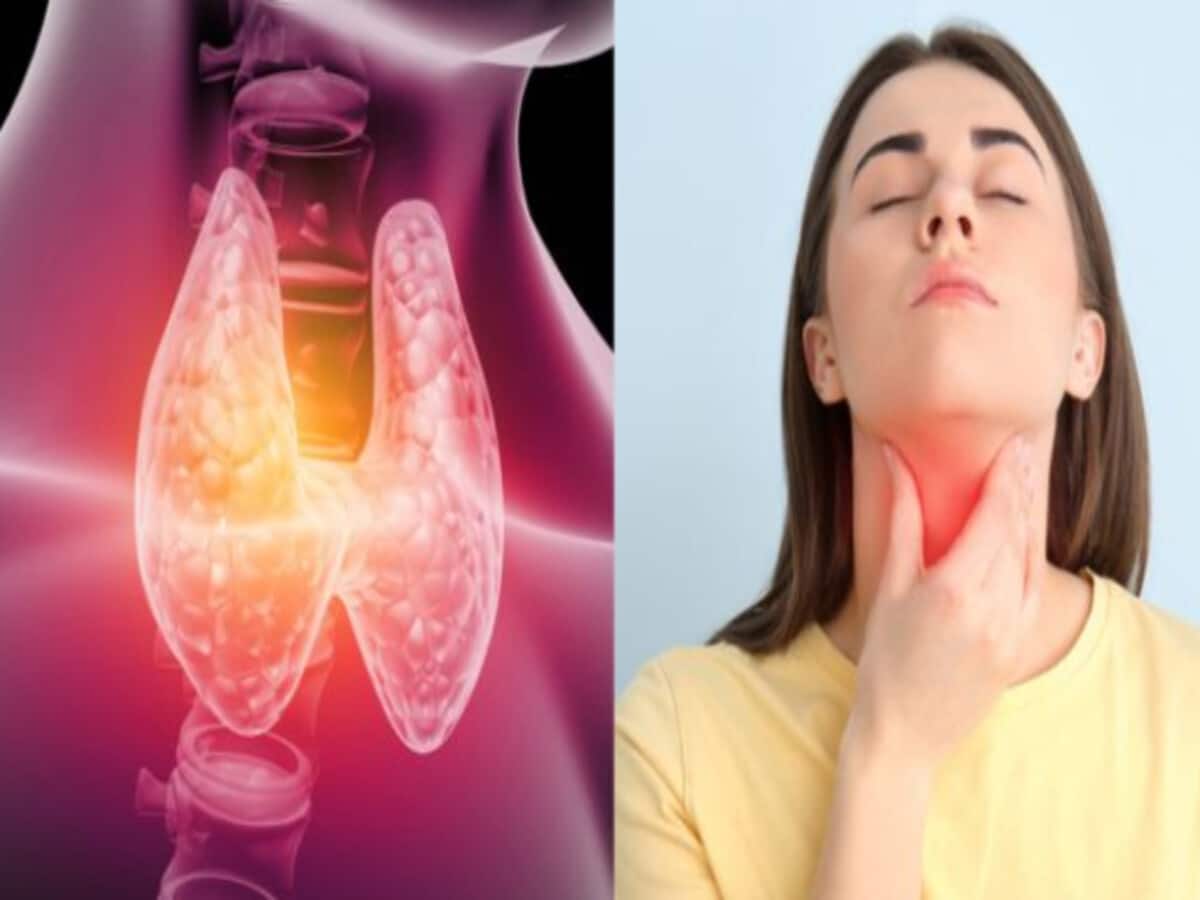 these-5-essential-nutrients-to-your-diet-to-control-thyroid-problems – पोषक तत्वों की कमी से गंभीर हो सकती है थायराॅइड की समस्या, इन 5 पोषक तत्वों का जरूर रखें ध्यान, लाइफस्टाइल न्यूज these-5-essential-nutrients-to-your-diet-to-control-thyroid-problems – पोषक तत्वों की कमी से गंभीर हो सकती है थायराॅइड की समस्या, इन 5 पोषक तत्वों का जरूर रखें ध्यान, लाइफस्टाइल न्यूज