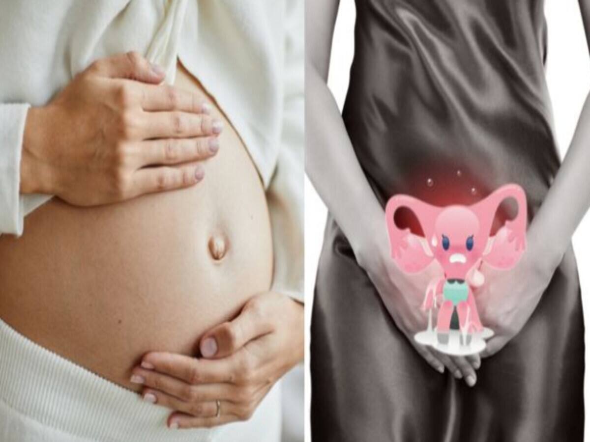 Is it normal to have vaginal discharge during pregnancy Know here Is it normal to have vaginal discharge during pregnancy Know here