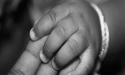 पिता ने की हैवानित की सारी हदें पार, दो बच्चियों को गर्म चीमटे से जलाया; रोती-बिलखती रहीं मासूम