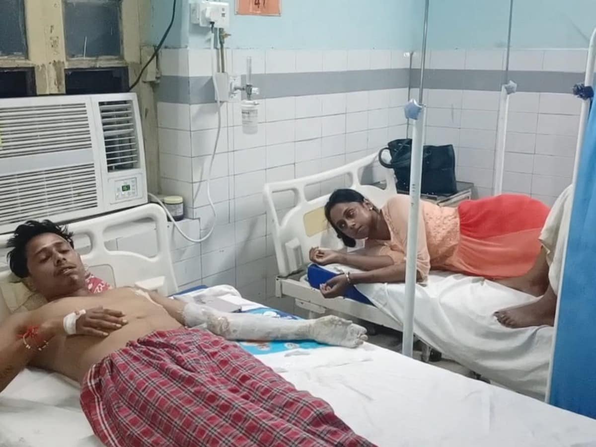 चोरी हुई बाइक पहचानी तो आरोपी ने गर्म तेल फेंक तीन सगे भाई-बहन को जलाया, आरोपी फरार चोरी हुई बाइक पहचानी तो आरोपी ने गर्म तेल फेंक तीन सगे भाई-बहन को जलाया, आरोपी फरार