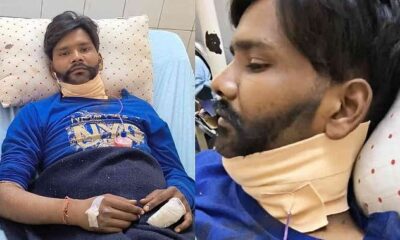 चीनी मांझे से लगातार बढ़ रहे हादसे, मांझे की चपेट में आने युवक की गर्दन पर लगे 42 टांके…