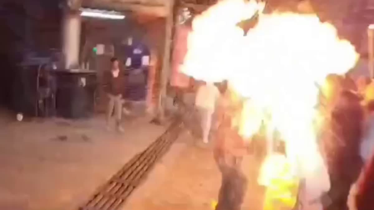 मशाल जुलूस में आग भड़कने से युवक झुलसा, विरोध प्रदर्शन के बीच बाल-बाल बची जान ! मशाल जुलूस में आग भड़कने से युवक झुलसा, विरोध प्रदर्शन के बीच बाल-बाल बची जान !